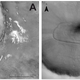 The two craters containing the moraine-like ridges. The collapsing ice is hypothesized to have fallen from right to left, starting near the outer slopes of the impact craters.